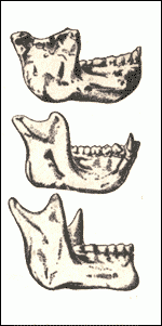 Comparison of jaws